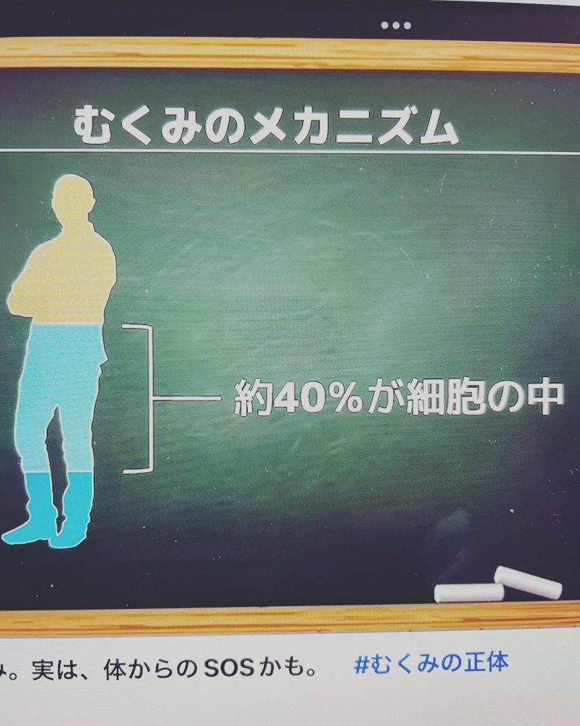 #むくみは体からのSOS 足のむくみは運動不足により、足の筋肉が低下し血液が固まり血栓や静脈瘤を引き起こす可能性がある。